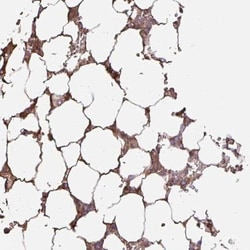 Glycosyltransferase-Like 1B Antibody, Novus Biologicals:Antibodies:Primary