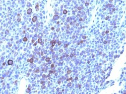 Glypican 3 Antibody (1G12 + GPC3/863), Novus Biologicals 0.2mg; Unlabeled:Antibodies,