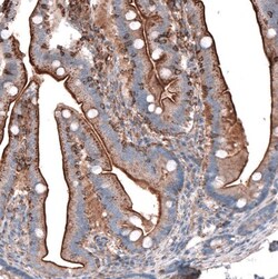 Glypican 6 Antibody, Novus Biologicals 0.1mL; Unlabeled:Antibodies, Polyclonal