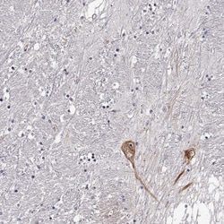 GnRH Antibody, Novus Biologicals 0.1mL; Unlabeled:Antibodies, Polyclonal