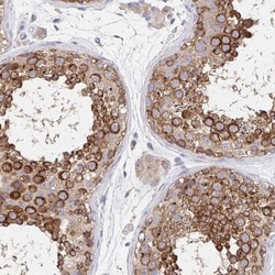 Golgin 97 Antibody, Novus Biologicals 25 &mu;L, Unlabeled:Antibodies, Polyclonal