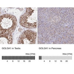 Golgin 97 Antibody, Novus Biologicals 25 &mu;L, Unlabeled:Antibodies, Polyclonal