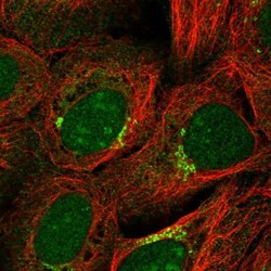 Gonadotropin Inducible Transcription Repressor 1 Antibody, Novus Biologicals