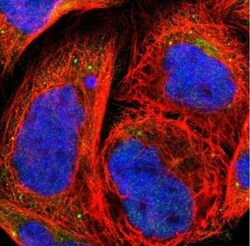 Granulin Antibody, Novus Biologicals 25 &mu;L | Buy Online | Novus Biologicals | Fisher Scientific