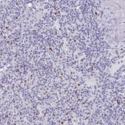 Granulysin Antibody, Novus Biologicals:Antibodies:Primary Antibodies