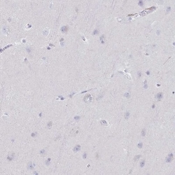 Granulysin Antibody, Novus Biologicals:Antibodies:Primary Antibodies