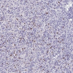 Granulysin Antibody, Novus Biologicals:Antibodies:Primary Antibodies