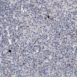 Granzyme H Antibody, Novus Biologicals 25 &mu;L; Unlabeled:Antibodies,