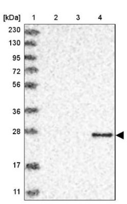 Granzyme H Antibody, Novus Biologicals 25 &mu;L; Unlabeled:Antibodies,