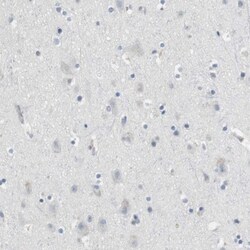 Granzyme M Antibody, Novus Biologicals:Antibodies:Primary Antibodies