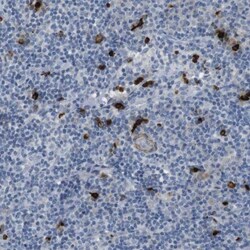 Granzyme M Antibody, Novus Biologicals:Antibodies:Primary Antibodies