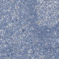 Guanine deaminase Antibody, Novus Biologicals:Antibodies:Primary Antibodies