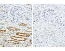 Novus Biologicals H.O.H.(TM) (Human on Human) Immunodetection Kit 1 Kit | Buy Online | Novus Biologicals&trade; | Fisher Scientific