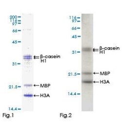 Novus Biologicals Recombinant Human MNK1 GST (N-Term) Protein 25 &mu;g | Buy Online | Novus Biologicals&trade; | Fisher Scientific