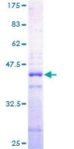 Novus Biologicals Recombinant Human H2A GST (N-Term) Protein 25 &mu;g | Buy Online | Novus Biologicals&trade; | Fisher Scientific