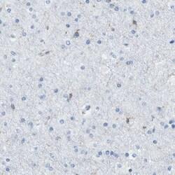 HA-1 Antibody, Novus Biologicals 25 &mu;L; Unlabeled:Antibodies, Polyclonal