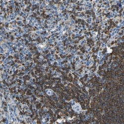 HA-1 Antibody, Novus Biologicals 25 &mu;L; Unlabeled:Antibodies, Polyclonal