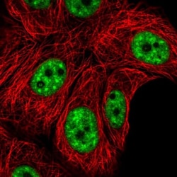 HA95/AKAP8L Antibody, Novus Biologicals 25 &mu;L; Unlabeled:Antibodies,