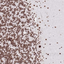 HA95/AKAP8L Antibody, Novus Biologicals 25 &mu;L; Unlabeled:Antibodies,