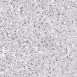 HA95/AKAP8L Antibody, Novus Biologicals 25 &mu;L; Unlabeled:Antibodies,