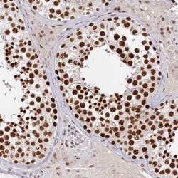 HA95/AKAP8L Antibody, Novus Biologicals 25 &mu;L; Unlabeled:Antibodies,