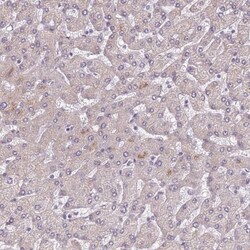 HA95/AKAP8L Antibody, Novus Biologicals 0.1mL; Unlabeled:Antibodies, Polyclonal