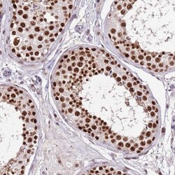 HA95/AKAP8L Antibody, Novus Biologicals 0.1mL; Unlabeled:Antibodies, Polyclonal