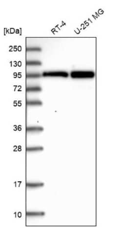 HA95/AKAP8L Antibody, Novus Biologicals 25 &mu;L; Unlabeled:Antibodies,