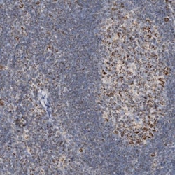 HABP1/C1QBP/GC1q R Antibody, Novus Biologicals:Antibodies:Primary Antibodies