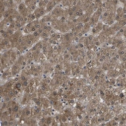 HADHA Antibody, Novus Biologicals 0.1mL; Unlabeled:Antibodies, Polyclonal