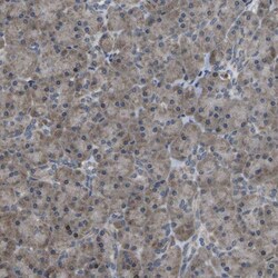 HADHA Antibody, Novus Biologicals 0.1mL; Unlabeled:Antibodies, Polyclonal