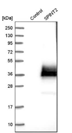 HAI-2/SPINT2 Antibody, Novus Biologicals:Antibodies:Primary Antibodies