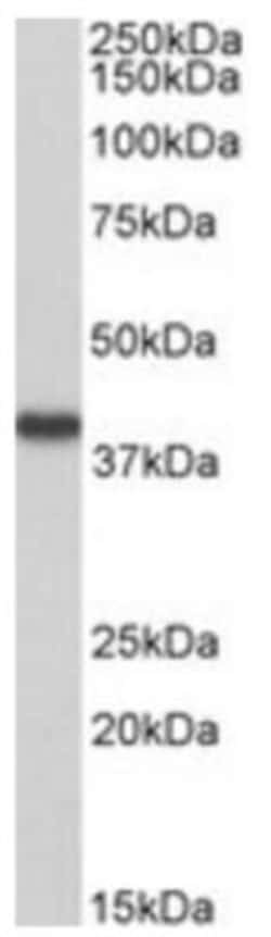 HAO2 Antibody, Novus Biologicals 0.1 mg, Unlabeled:Antibodies, Polyclonal