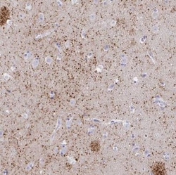 HAPLN2 Antibody, Novus Biologicals 0.1mL; Unlabeled:Antibodies, Polyclonal