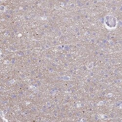 HAPLN2 Antibody, Novus Biologicals 0.1mL; Unlabeled:Antibodies, Polyclonal