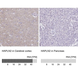 HAPLN2 Antibody, Novus Biologicals 0.1mL; Unlabeled:Antibodies, Polyclonal