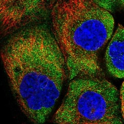HARS Antibody, Novus Biologicals:Antibodies:Primary Antibodies