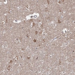 HARS Antibody, Novus Biologicals:Antibodies:Primary Antibodies