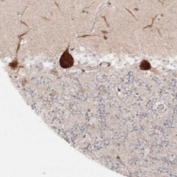 HARS Antibody, Novus Biologicals:Antibodies:Primary Antibodies