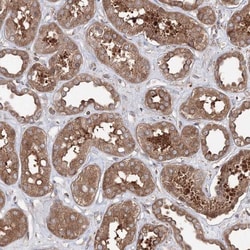 HARS Antibody, Novus Biologicals:Antibodies:Primary Antibodies