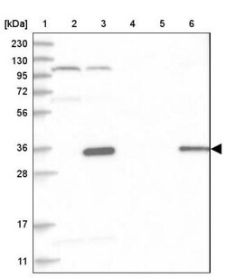 HAUS4 Antibody, Novus Biologicals 0.1mL; Unlabeled:Antibodies, Polyclonal