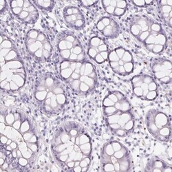 HBQ1 Antibody, Novus Biologicals:Antibodies:Primary Antibodies