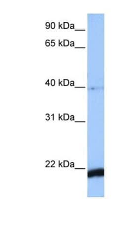 HBS1L Antibody, Novus Biologicals 100&mu;L; Unlabeled:Antibodies, Polyclonal
