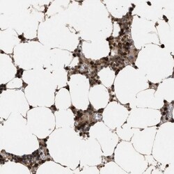 HCA59 Antibody, Novus Biologicals 0.1mL; Unlabeled:Antibodies, Polyclonal