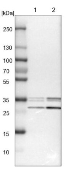 HCA59 Antibody, Novus Biologicals 0.1mL; Unlabeled:Antibodies, Polyclonal