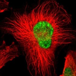 HCC1 Antibody, Novus Biologicals 0.1mL; Unlabeled:Antibodies, Polyclonal