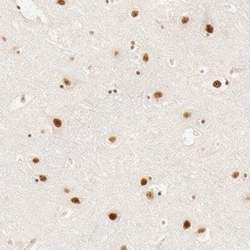 HCC1 Antibody, Novus Biologicals 0.1mL; Unlabeled:Antibodies, Polyclonal
