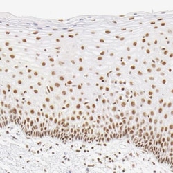 HCC1 Antibody, Novus Biologicals 0.1mL; Unlabeled:Antibodies, Polyclonal