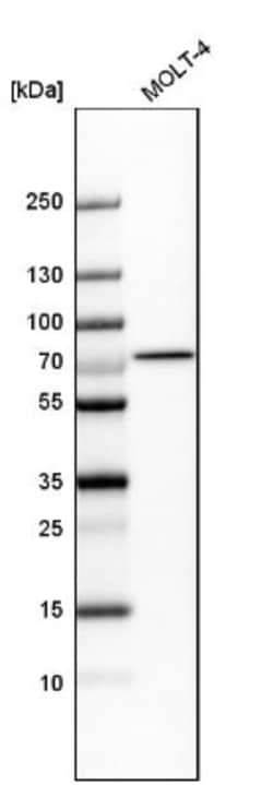 HCC1 Antibody, Novus Biologicals 0.1mL; Unlabeled:Antibodies, Polyclonal