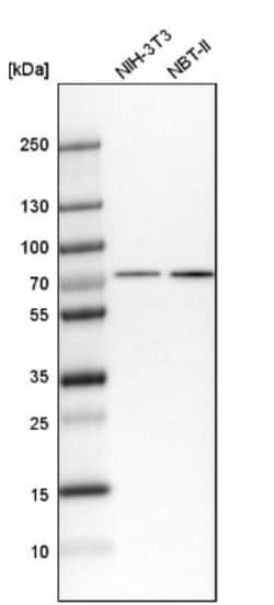 HCC1 Antibody, Novus Biologicals 0.1mL; Unlabeled:Antibodies, Polyclonal